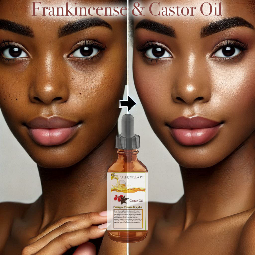 Castor Oil & Frankincense